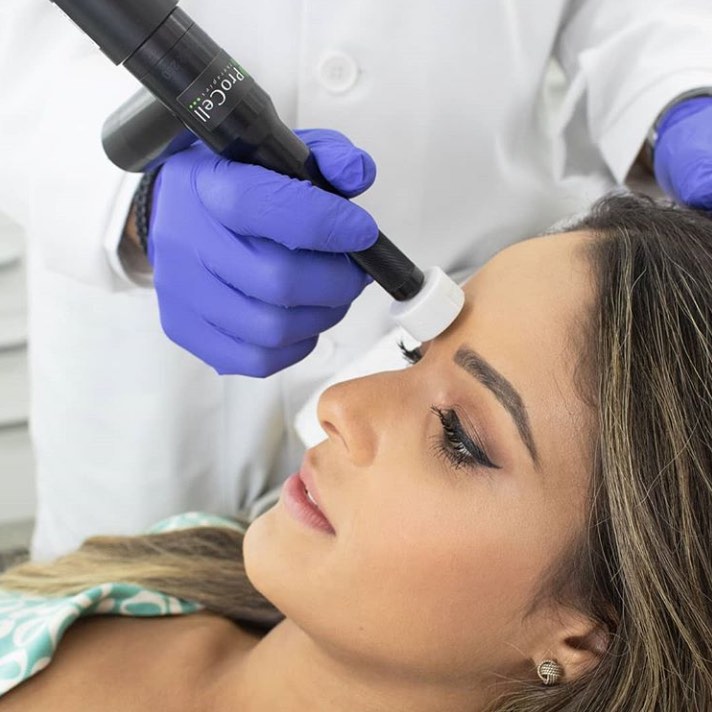 A Procell device used during a microchanneling facial